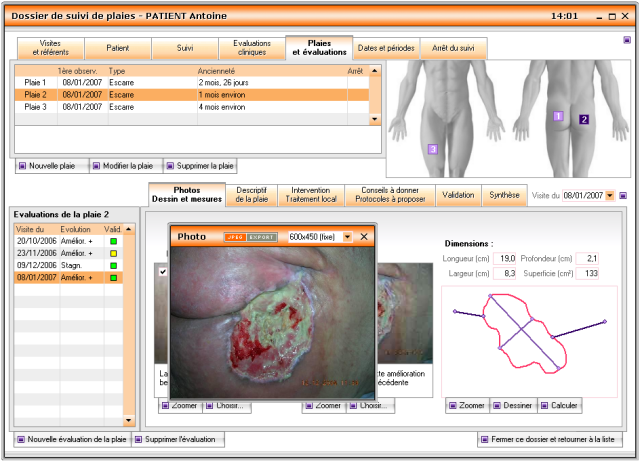 Dossier de suivi de plaie