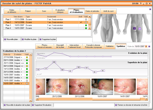 Dossier de suivi de plaie